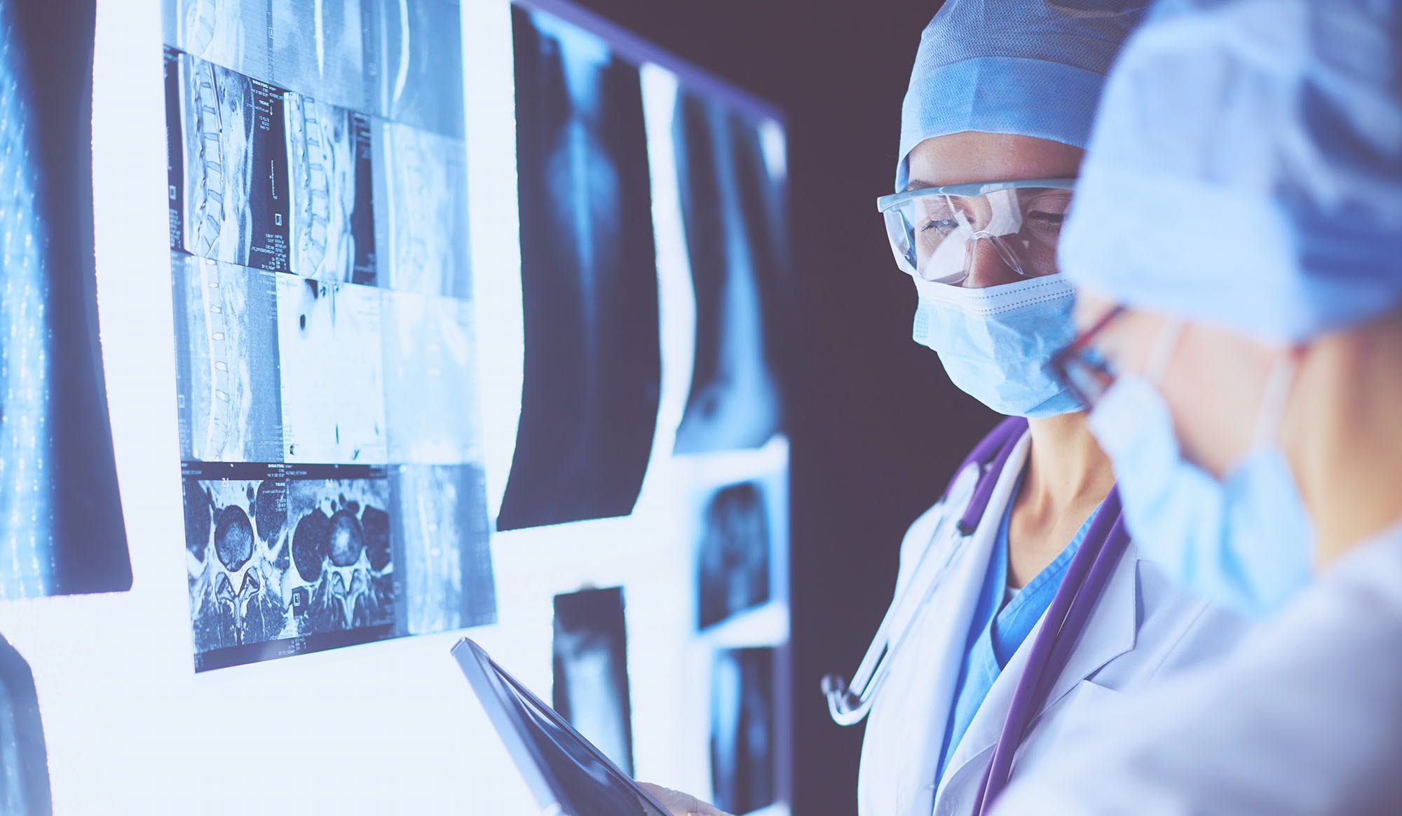 2 female doctors reviewing X-rays