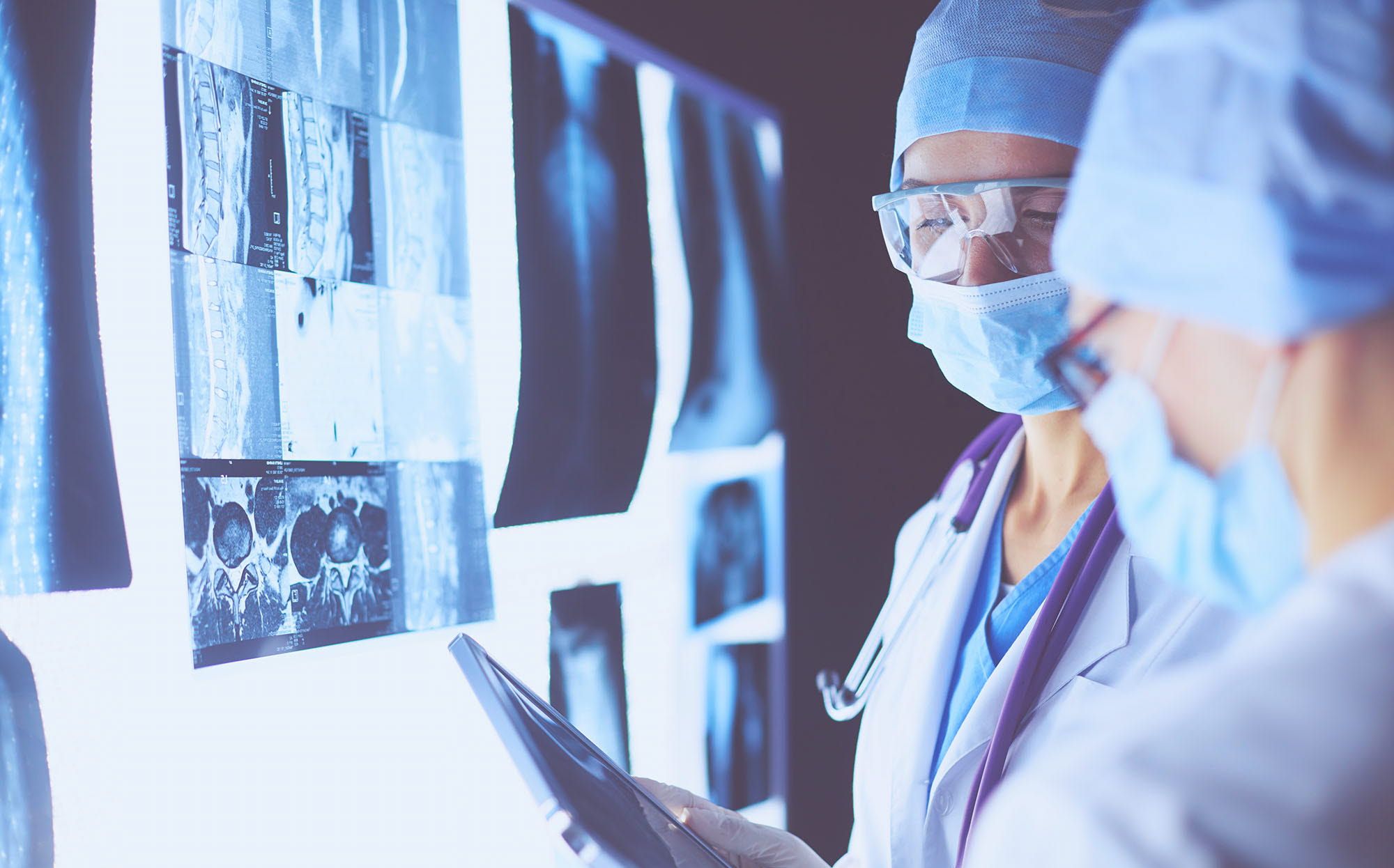 2 female doctors reviewing X-rays