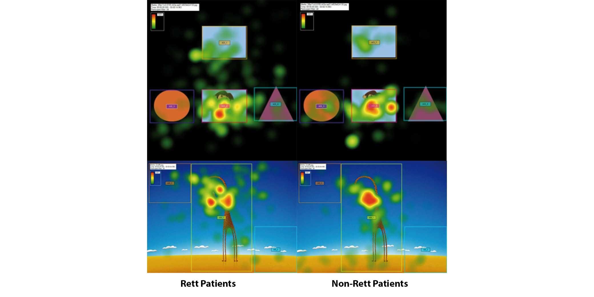 Gaze plots illustrating Rett and non-Rett individuals attention span.